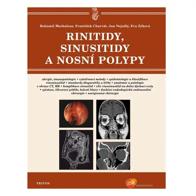 Rinitidy, sinusitidy a nosní polypy