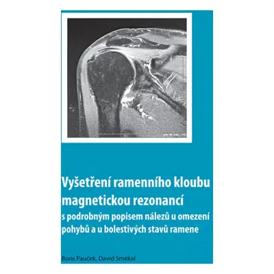 Vyšetření ramenního kloubu magnetickou rezonancí s podrobným popisem nálezů u omezení pohybů u b