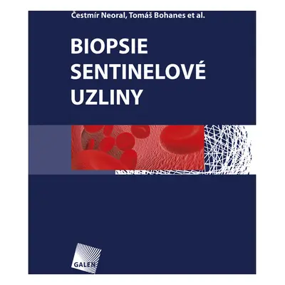 Biopsie sentinelové uzliny