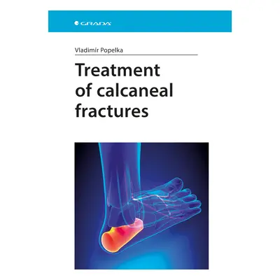 E-kniha: Treatment of calcaneal fractures od Popelka Vladimír