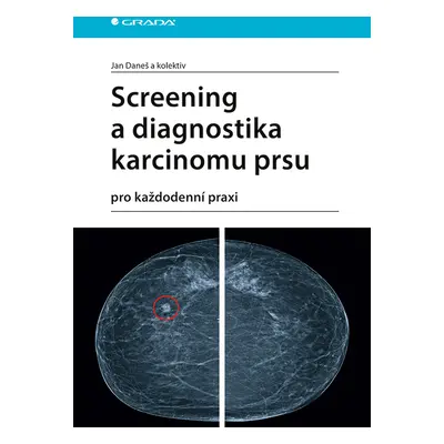 E-kniha: Screening a diagnostika karcinomu prsu od Daneš Jan