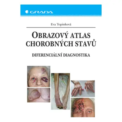 E-kniha: Obrazový atlas chorobných stavů od Topinková Eva