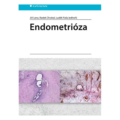 E-kniha: Endometrióza od Lenz Jiří