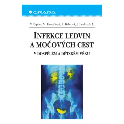 E-kniha: Infekce ledvin a močových cest od Teplan Vladimír