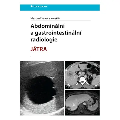 Kniha: Abdominální a gastrointestinální radiologie od Válek Vlastimil