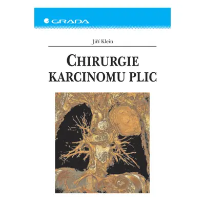 E-kniha: Chirurgie karcinomu plic od Klein Jiří