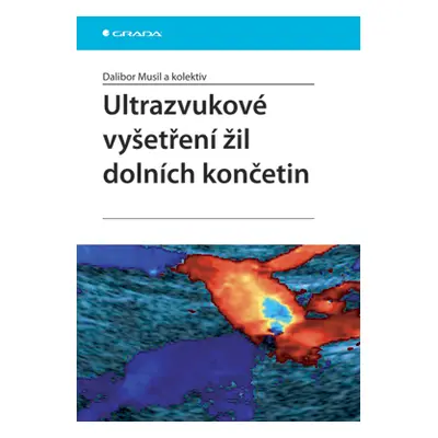 E-kniha: Ultrazvukové vyšetření žil dolních končetin od kolektiv