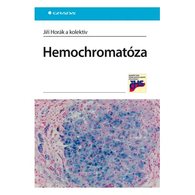 E-kniha: Hemochromatóza od Horák Jiří