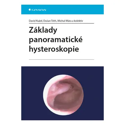 E-kniha: Základy panoramatické hysteroskopie od Kužel David