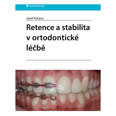 Kniha: Retence a stabilita v ortodontické léčbě od Kučera Josef