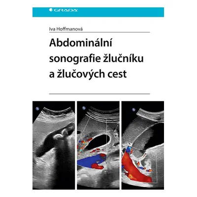 E-kniha: Abdominální sonografie žlučníku a žlučových cest od Hoffmanová Iva