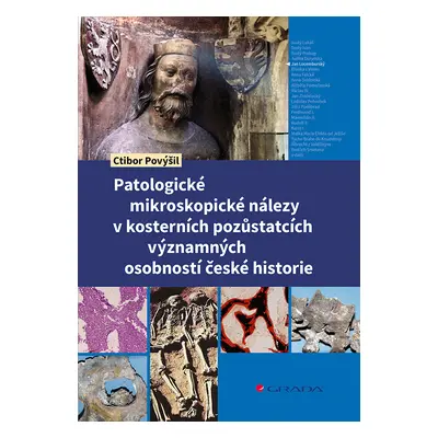 Kniha: Patologické mikroskopické nálezy v kosterních pozůstatcích významných osobností české his