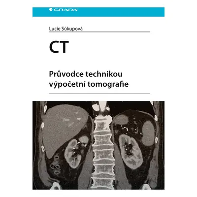 E-kniha: CT - Průvodce technikou výpočetní tomografie od Súkupová Lucie