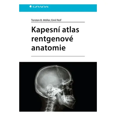 Kniha: Kapesní atlas rentgenové anatomie od Möller Torsten B.