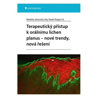 Kniha: Terapeutický přístup k orálnímu lichen planus - nové trendy, nová řešení od Janovská Mark