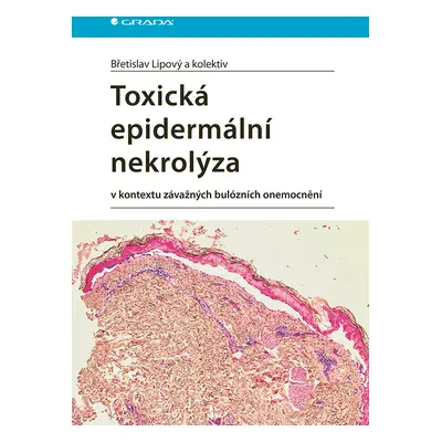 Kniha: Toxická epidermální nekrolýza od Lipový Břetislav