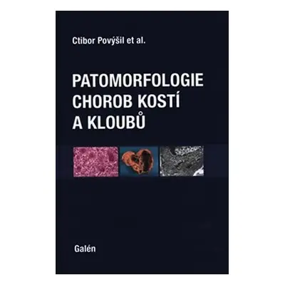 Patomorfologie chorob kostí a kloubů - Ctibor Povýšil