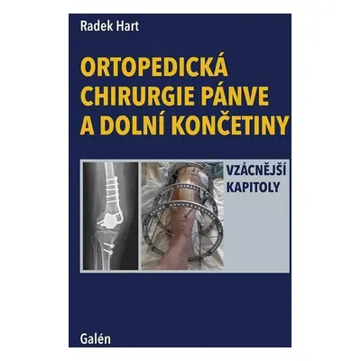 Ortopedická chirurgie pánve a dolní končetiny - Vzácnější kapitoly - Radek Hart