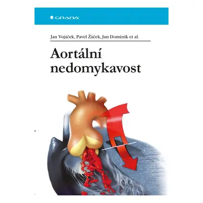 Aortální nedomykavost - Jan Dominik