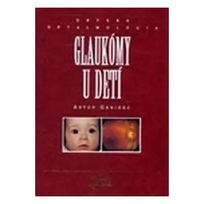 Glaukómy u detí - Anton Gerinec