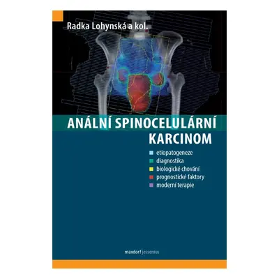 Anální spinocelulární karcinom - kolektiv autorů