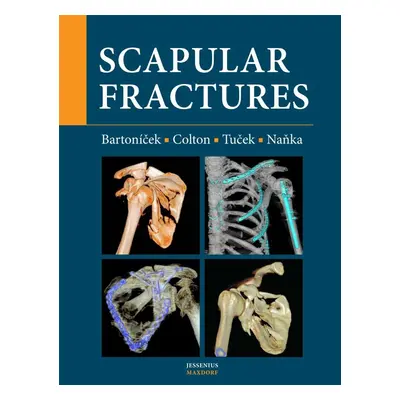 Scapular fractures - Ondřej Naňka