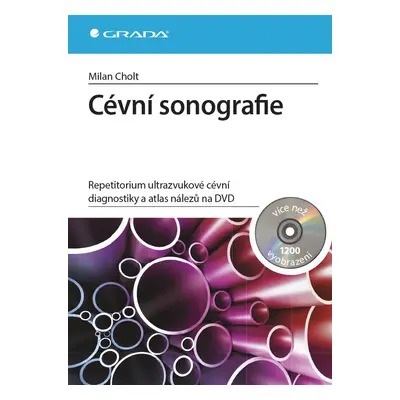 Cévní sonografie - repetitorium ultrazvukové cévní diagnostiky a atlas nálezů na DVD - Milan Cho