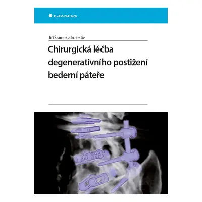 Chirurgická léčba degenerativního postižení bederní páteře - Jiří Šrámek