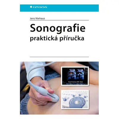 Sonografie - praktická příručka - Jens Niehaus