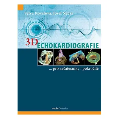 3D Echokardiografie - Sylva Kovalová