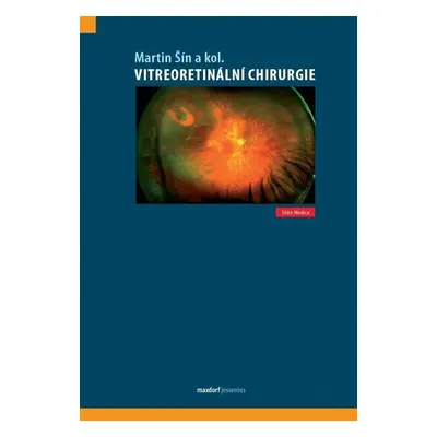 Vitreoretinální chirurgie - Martin Šín