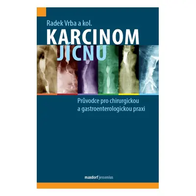 Karcinom jícnu - Průvodce pro chirurgickou a gastroenterologickou praxi - Radek Vrba