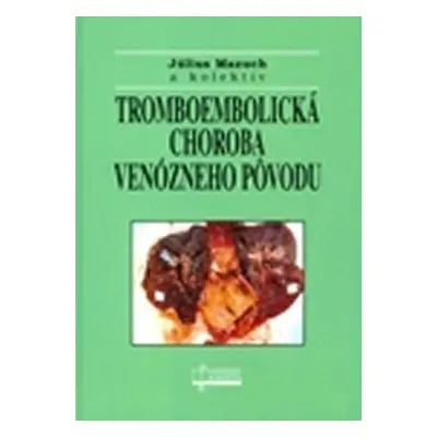 Tromboembolická choroba venózneho pôvodu - Július Mazuch