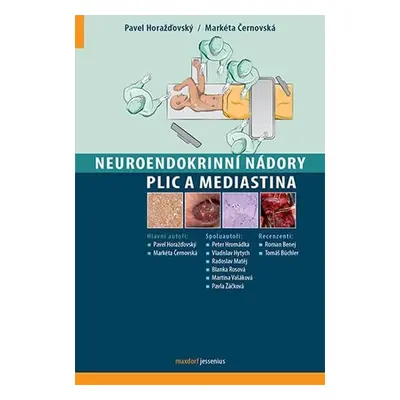 Neuroendokrinní nádory plic a mediastina - Markéta Černovská