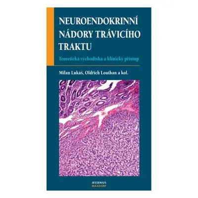 Neuroendokrinní nádory trávicí - Karel Lukáš; Oldřich Louthan