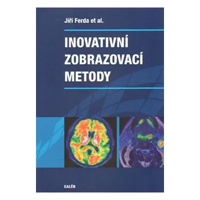 Inovativní zobrazovací metody - Jiří Ferda