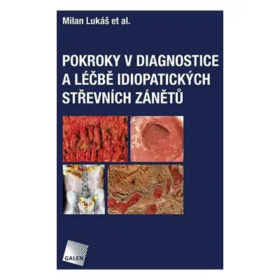 Pokroky v diagnostice a léčbě idiopatických střevních zánětů - Milan Lukáš