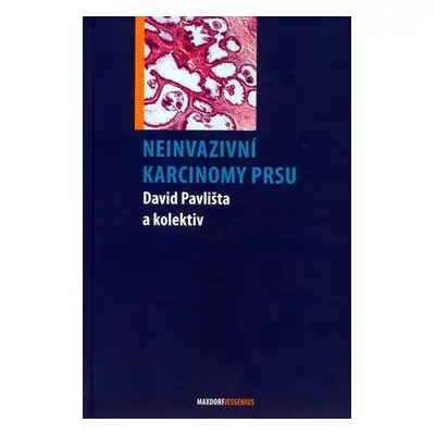 Neinvazivní karcinomy prsu - David Pavlišta