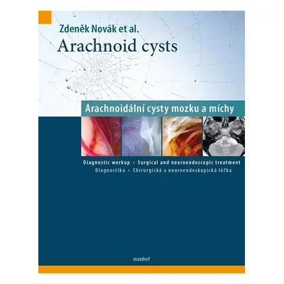 Arachnoid cysts - Arachnoidální cysty mozku a míchy - Zdeněk Novák