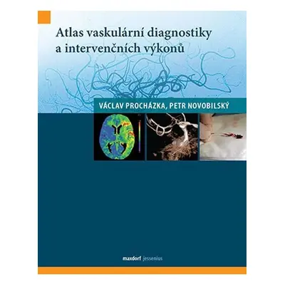 Atlas vaskulární diagnostiky a intervenčních výkonů - Petr Novobilský