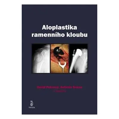 Aloplastika ramenního kloubu - David Pokorný