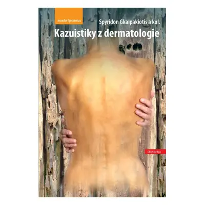 Kazuistiky z dermatologie - Spyridon Gkalpakiotis