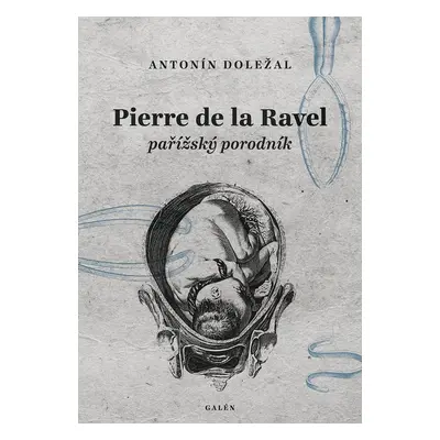 Pierre de la Ravel, pařížský porodník - Antonín Doležal