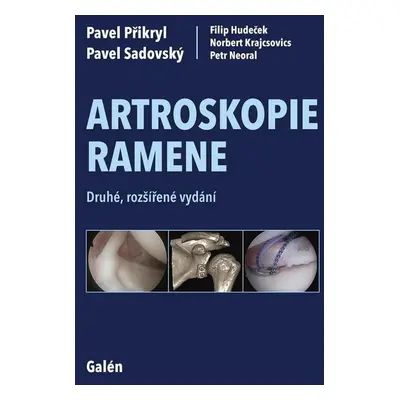 Artroskopie ramene - Pavel Přikryl