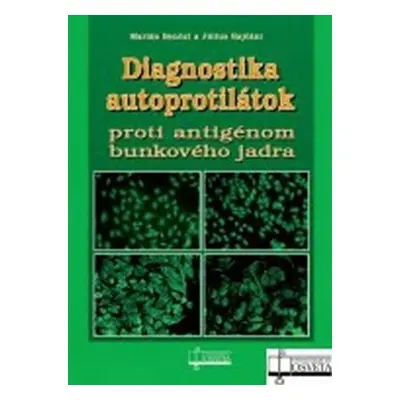 Diagnostika autoprotilátok proti antigénom bunkového jadra - Marián Benčat; Július Rajčáni