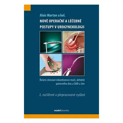 Nové operační postupy v urogynekologii - Řešení stresové inkontinence moči a defektů pánevního d