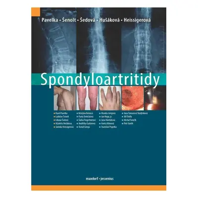 Spondyloartritidy - Karel Pavelka