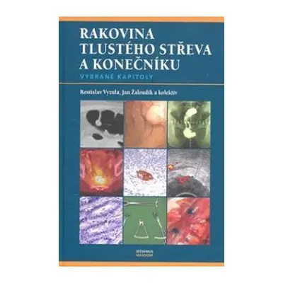 Rakovina tlustého střeva a konečníku - vybrané kapitoly - Rostislav Vyzula