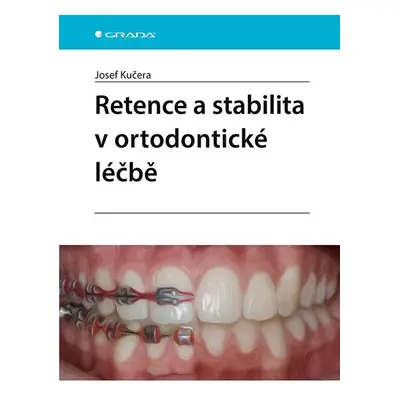 Retence a stabilita v ortodontické léčbě - Josef Kučera