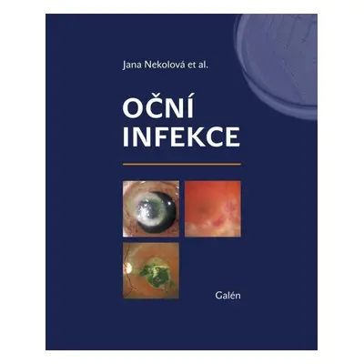 Oční infekce - Jana Nekolová